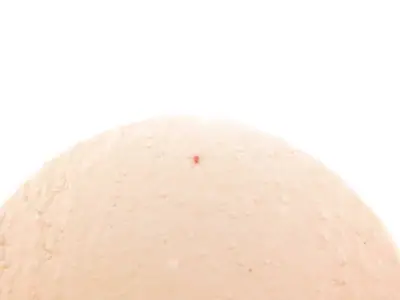 Červení pavoučci - prosím, poraďte